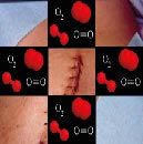 Estudio clínico observacional: Ventilación de oxígeno puro durante la anestesia general.